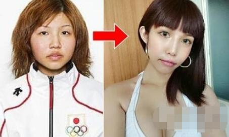 今井梦露（左图）曾代表日本参加2006年冬奥，之后整形（右图）